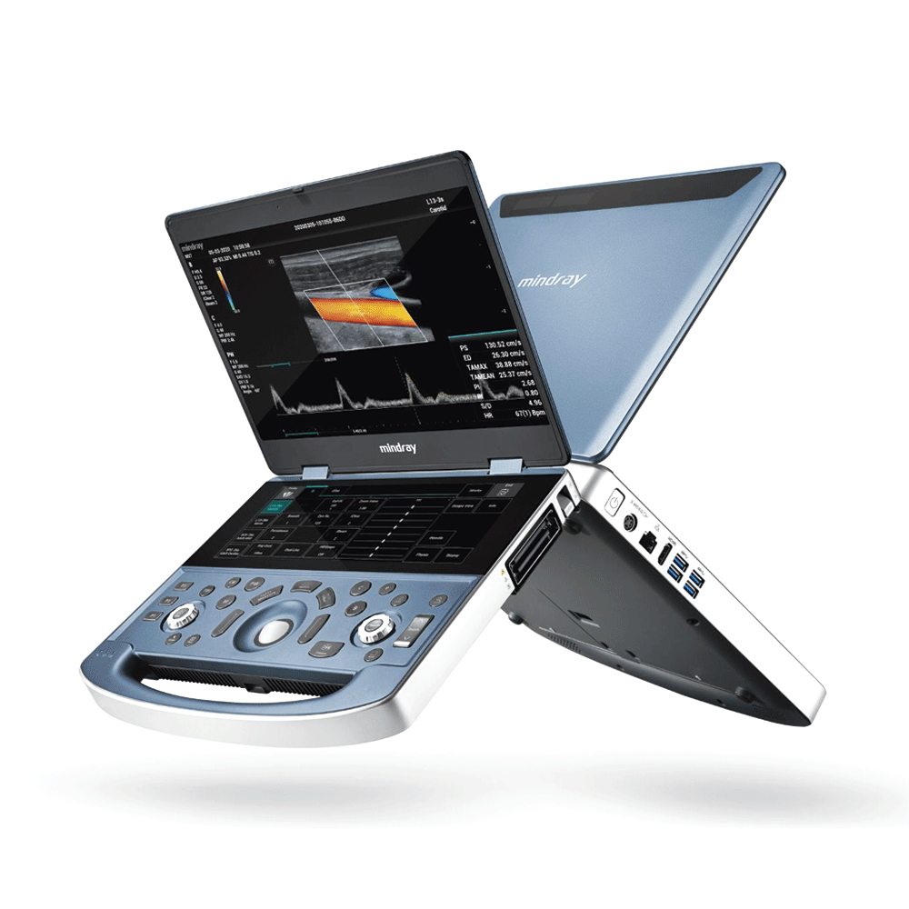 ecógrafo Mindray MX7
