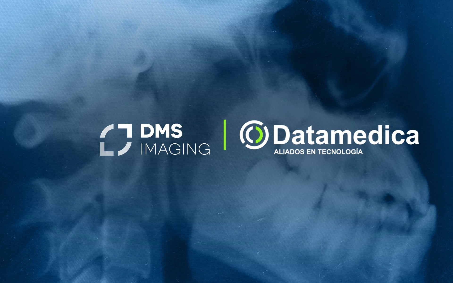 DMS_MOBILE.webp