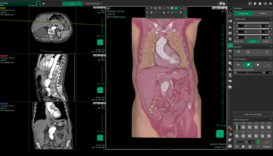 Fujifilm PACS Synapse AI es un software de reconocimiento con una amplia tecnología de imagen relacionado a distintas áreas anatómicas. 