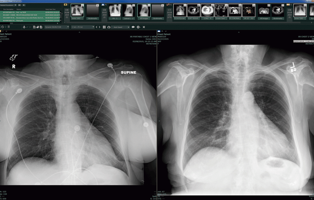 PACS-System.gif