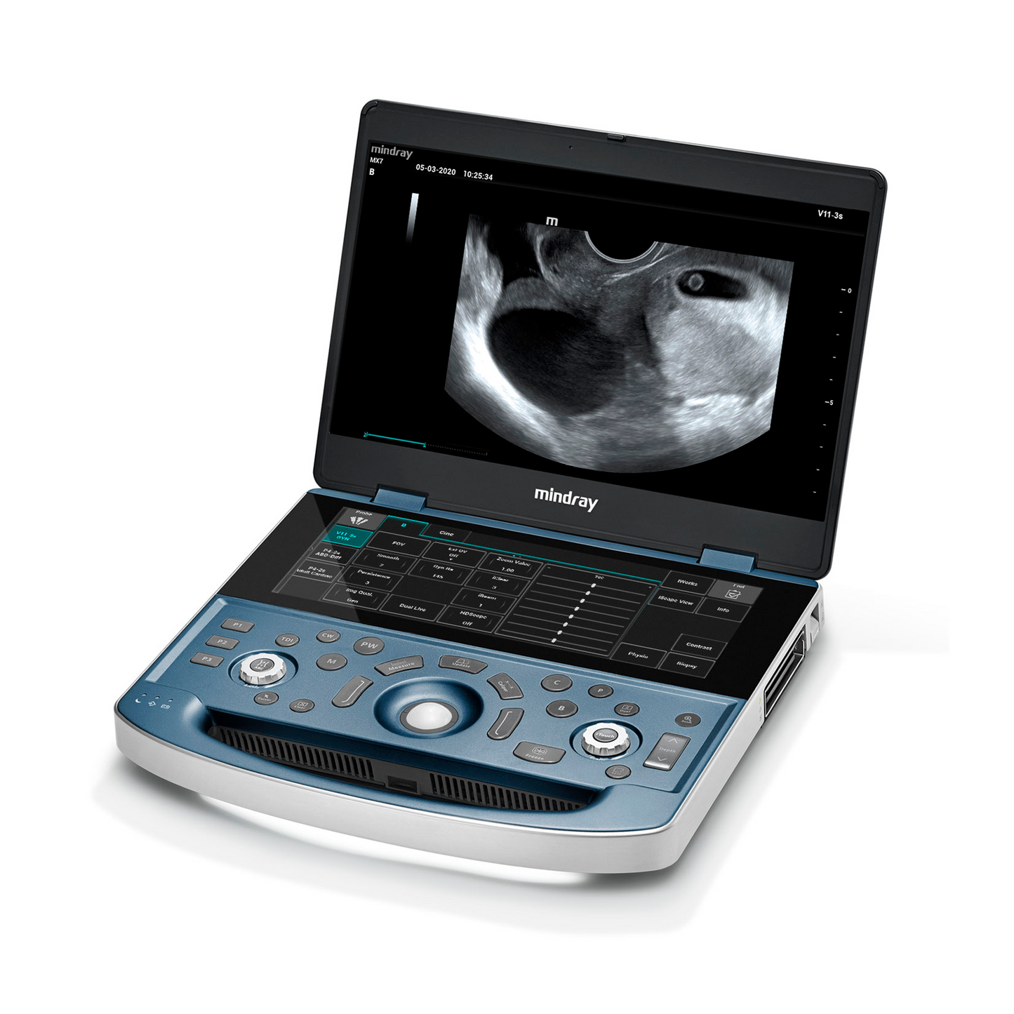 equipo médico portátil con una excelente calidad de diseño e imagen. 