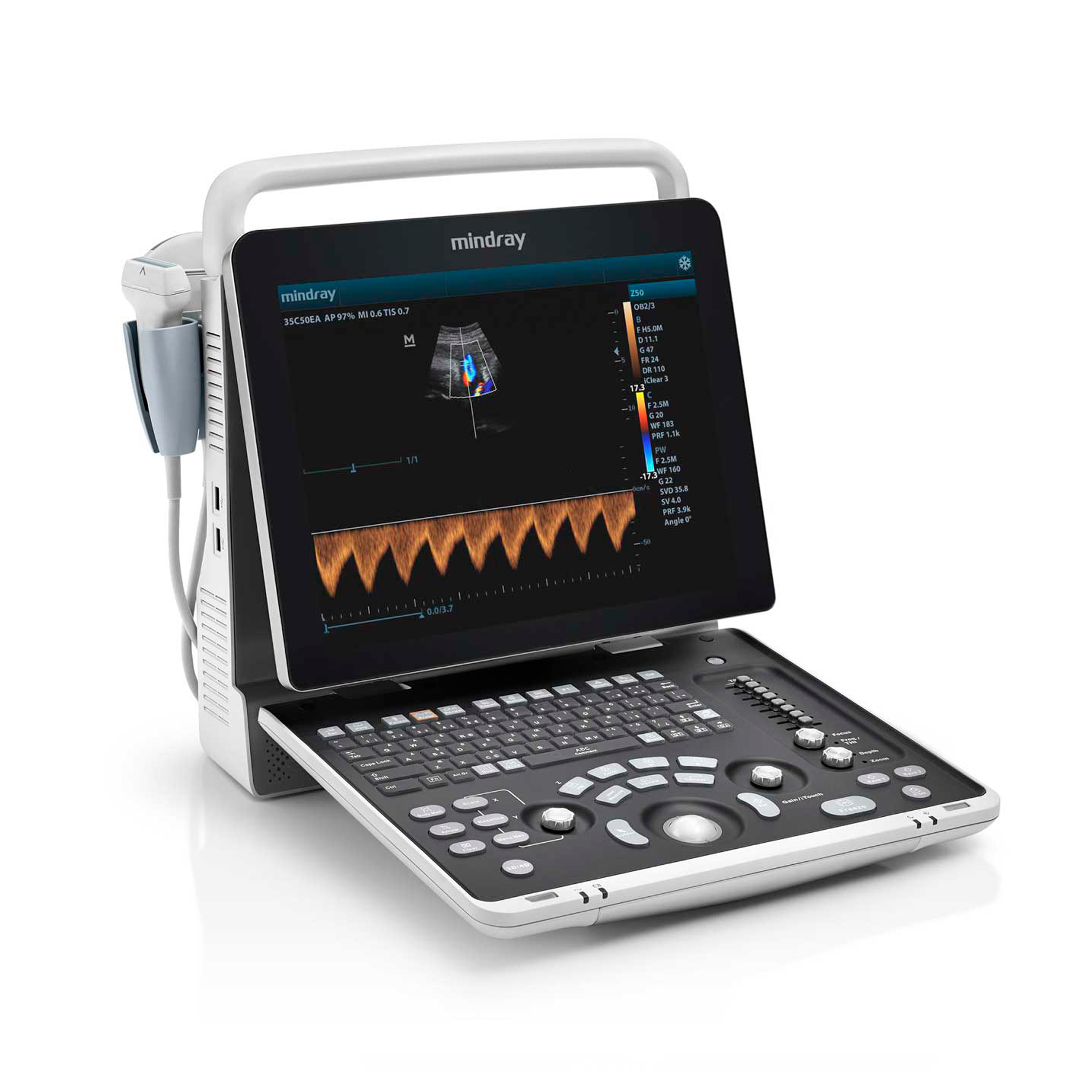 ecógrafo veterinario portátil Z-60 de Mindray. 
