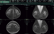 Synapse PACS Fujifilm