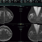 Synapse PACS Fujifilm
