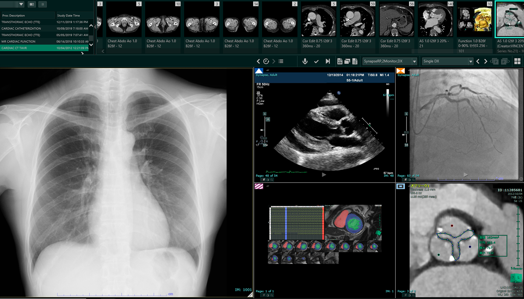 PACS Synapse Fujifilm